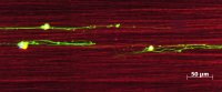Nervenzellen der Netzhaut (grün), die an elektrisch gesponnenen Seidenfäden (rot) entlangwachsen. (Maßstabsbalken: 50 Mikrometer; ) Quelle: Universitätsklinikum Leipzig