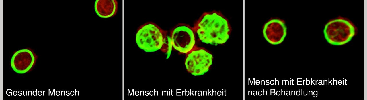 Blutplättchen. ©Arbeitsgruppe Nieswandt / Rudolf-Virchow-Zentrum. (nur in Verbindung mit der Pressemeldung)